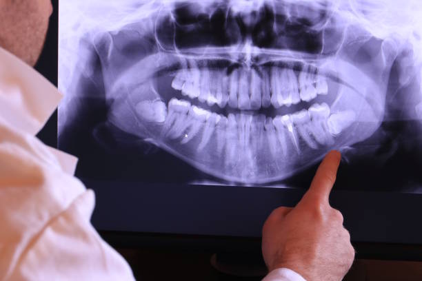 Best Tooth Infection Emergency Dentist  in Jersey City, NJ